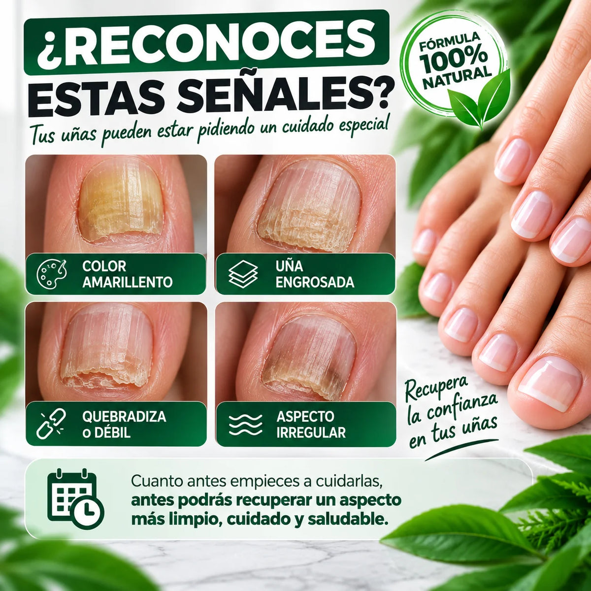 Nura — Aceite de Uñas para Hongos (Fórmula Intensiva Tea Tree)
